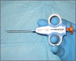 Figure 5 Core needle biopsy. Pictured is a Temno™ core needle which is ideal for harvesting tissue from subcutaneous or deep soft tissuemasses.