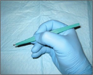 Figure 4 Curettage. This technique can be used for sampling superficial lesions which can be “scraped off” the skin surface.