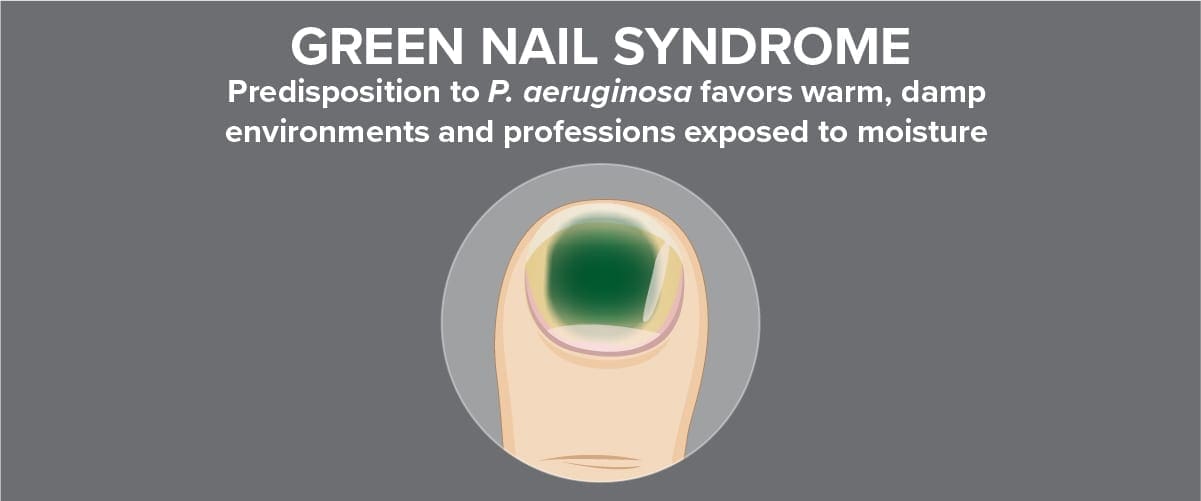Pseudomonas aeruginosa Test for Green Nail Syndrome - Bako Diagnostics
